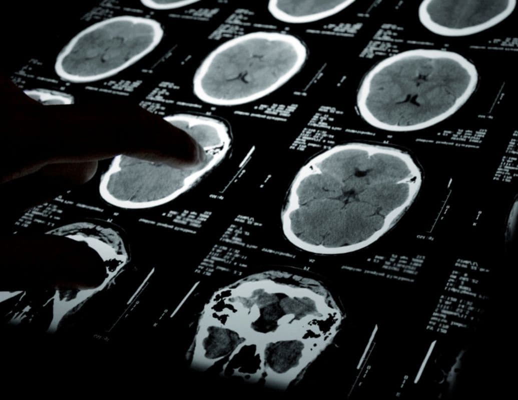 brain function